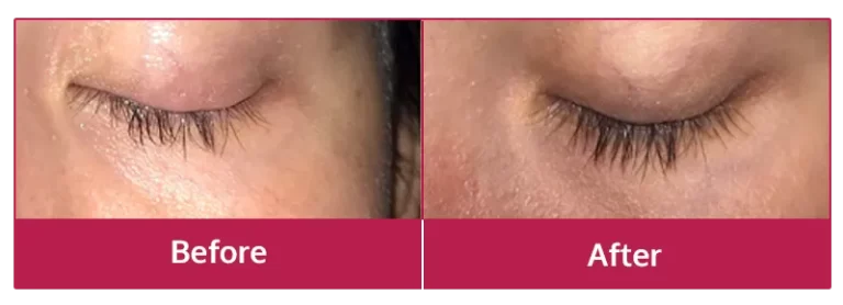 Miracle Lash Benefits